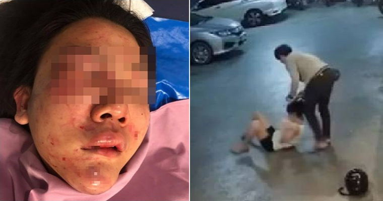 Girl Suffers Serious Injuries After Getting Brutally Beaten Up By Drunk And Jealous Gf - World Of Buzz