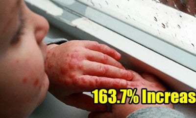 Negri Sembilan Shockingly Reported To Have 163.7 Per Cent Hike In Hfmd Cases - World Of Buzz