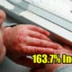 Negri Sembilan Shockingly Reported To Have 163.7 Per Cent Hike In Hfmd Cases - World Of Buzz