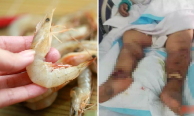Woman Suffers Organ Failure And Dies After Accidentally Cutting Finger When Cleaning Shrimps - World Of Buzz 4