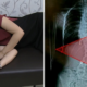 Young Girl Always Lies On Her Side To Play Her Phone, Develops 50 Degrees Curved Spine - World Of Buzz 2