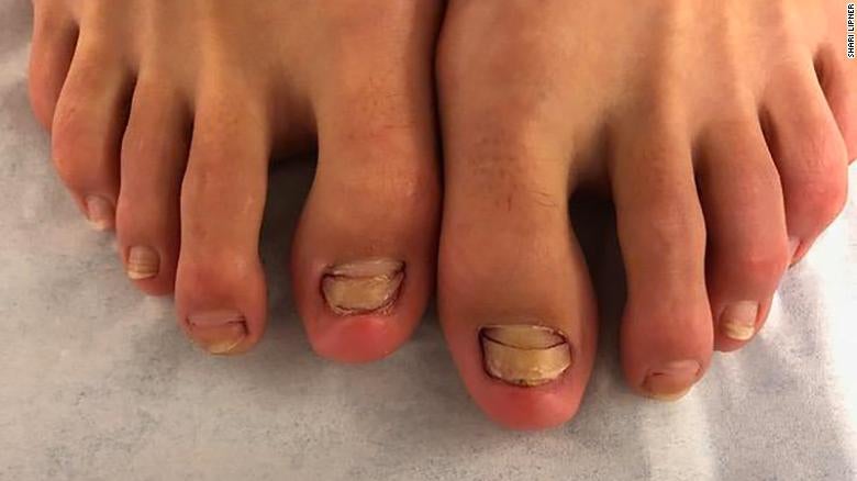 Young Woman Shockingly Loses Her Toenails After Going for Fish Pedicure - WORLD OF BUZZ 1