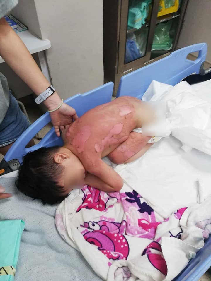 2yo M'sian Boy Suffers Second-Degree Burns After Stove in Kitchen Explodes - WORLD OF BUZZ 1