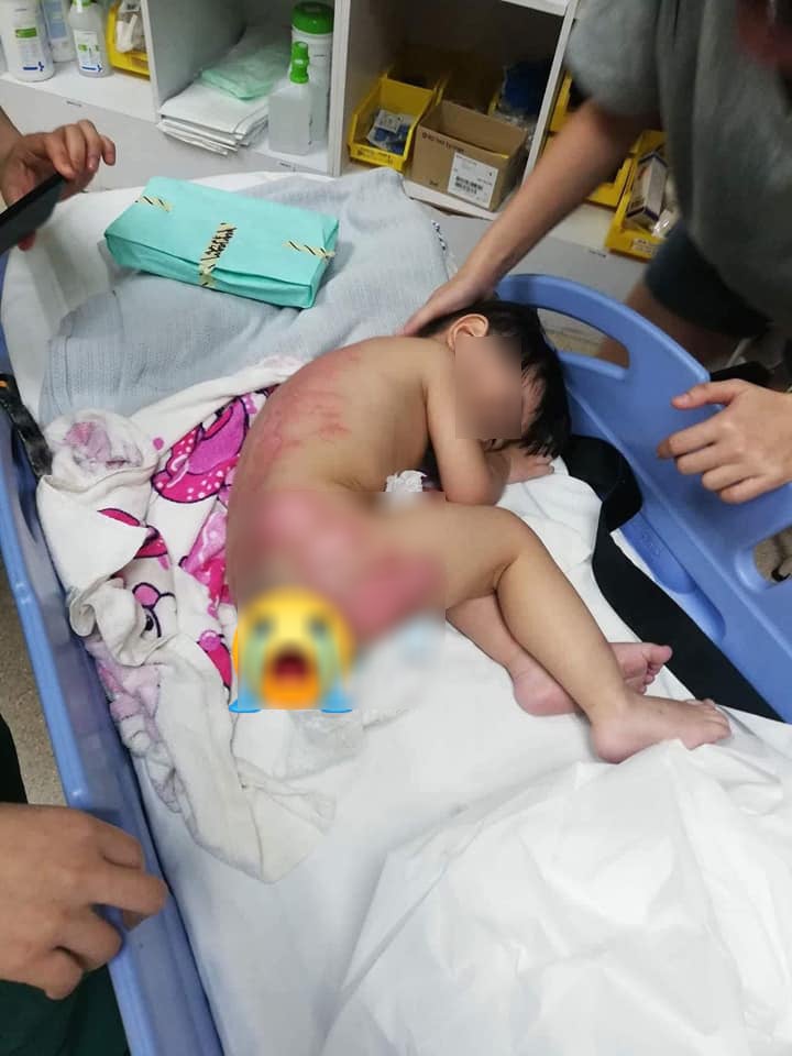2yo M'sian Boy Suffers Second-Degree Burns After Stove in Kitchen Explodes - WORLD OF BUZZ 2