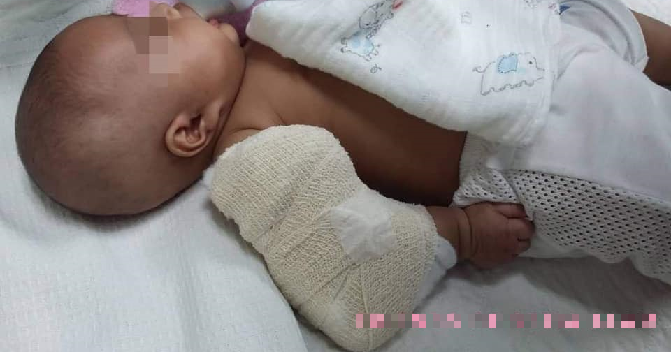 3-Month-Old M'sian Baby Boy Suffers Broken Arm Allegedly from Nanny's Ill-Treatment - WORLD OF BUZZ 3