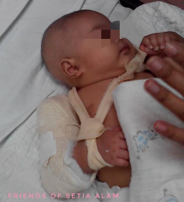 3-Month-Old M'sian Baby Boy Suffers Broken Arm Allegedly From Nanny's Ill-Treatment - World Of Buzz