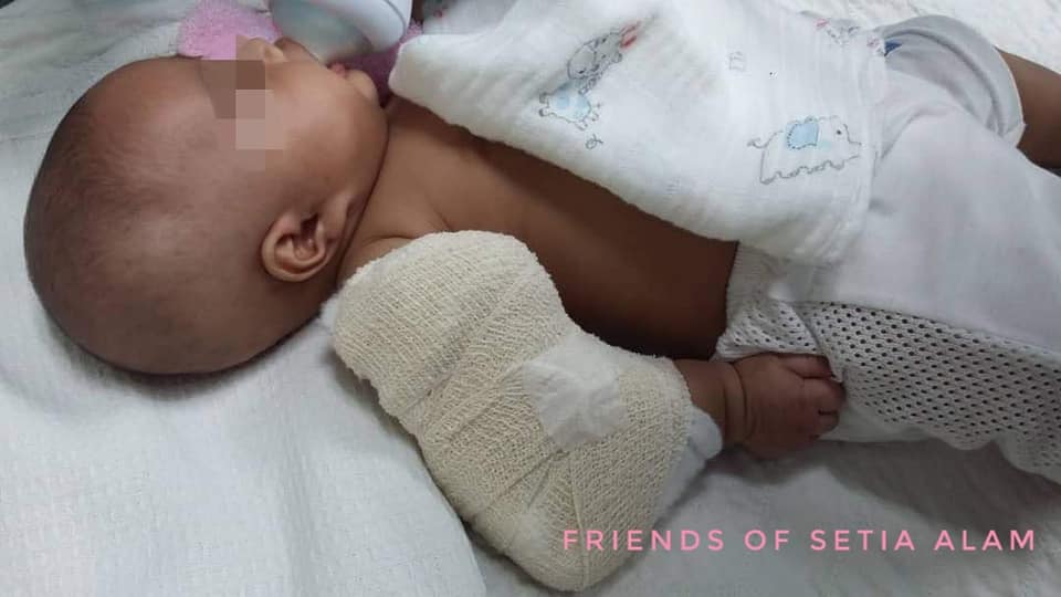 3-Month-Old M'sian Baby Boy Suffers Broken Arm At Nan - World Of Buzz