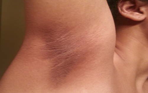 7 Reasons Some Malaysians Have Darker Armpits and How to Avoid Them - WORLD OF BUZZ 1