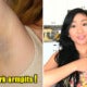 7 Reasons Some Malaysians Have Darker Armpits And How To Avoid Them - World Of Buzz 7