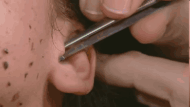 Bug Stuck Inside Your Ear? Don't Panic, Follow These Steps - WORLD OF BUZZ 2