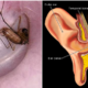 Bug Stuck Inside Your Ear? Don'T Panic, Follow These Steps - World Of Buzz 6