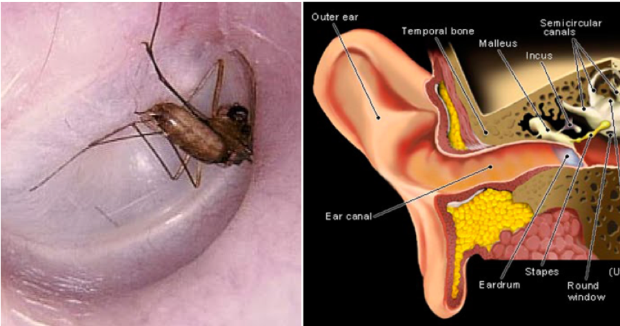 Bug Stuck Inside Your Ear? Don't Panic, Follow These Steps - WORLD OF BUZZ 6