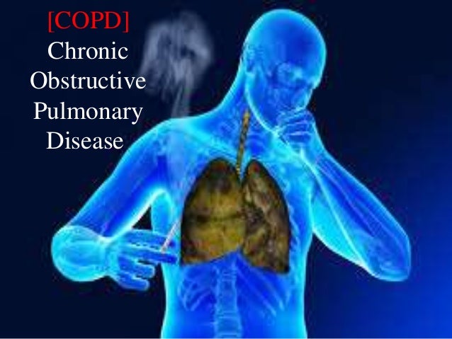 chronic obstructive pulmonary disease 1 638