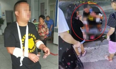 Bf Stages Robbery, Slashes Own Arms To Get Away From Buying Gf Luxurious Car - World Of Buzz