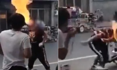 16Yo Teen Accidentally Sets His Face On Fire While Attempting Fire-Breathing Act - World Of Buzz
