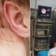 Girlfriend Kissed Boyfriend’s Ear Too Hard &Amp; Accidentally Ruptures His Eardrum - World Of Buzz