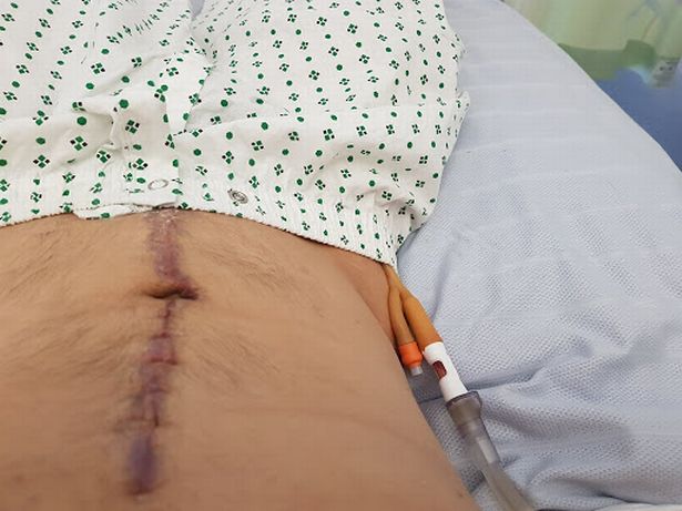 Man Believes His Ripped Six-Pack Abs Saved His Life When He Was Run Over by Truck - WORLD OF BUZZ 2