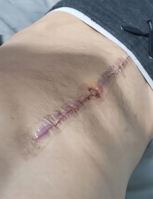 Man Believes His Ripped Six-Pack Abs Saved His Life When He Was Run Over by Truck - WORLD OF BUZZ 3