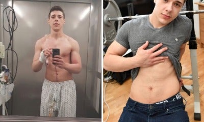 Man Believes His Ripped Six-Pack Abs Saved His Life When He Was Run Over By Truck - World Of Buzz 5