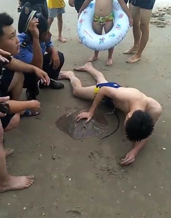 Man's Genitals Painfully Stab by Stingray While Swimming in The Sea - WORLD OF BUZZ