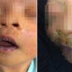 M'Sian Baby Contracted Highly Contagious Skin Disease From Infected Visitors At Hospital - World Of Buzz