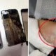 M'Sian Girl Suffers Burns On Hand Due To Charging Phone Overnight - World Of Buzz 1