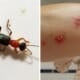 Penang Condo Residents Plagued By Venomous 'Charlie Ants', Here'S What They Are - World Of Buzz 4