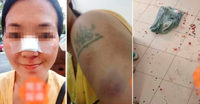 Msian Wife Brutally Beat Up By Husband Just Because She Said Something Wrong World Of Buzz