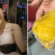 Woman'S Breast Implant Bursts On Plane, Doctor Refuses To Take Responsibility For Lifetime Warranty - World Of Buzz 5