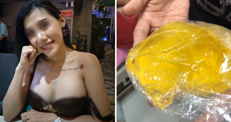 Woman's Breast Implant Bursts On Plane, Doctor Refuses to Take Responsibility for Lifetime Warranty - WORLD OF BUZZ 5