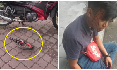 Boy'S Head Left Bloodied After Being Struck By Bicycle Part Thrown From Flat In Kl - World Of Buzz 1