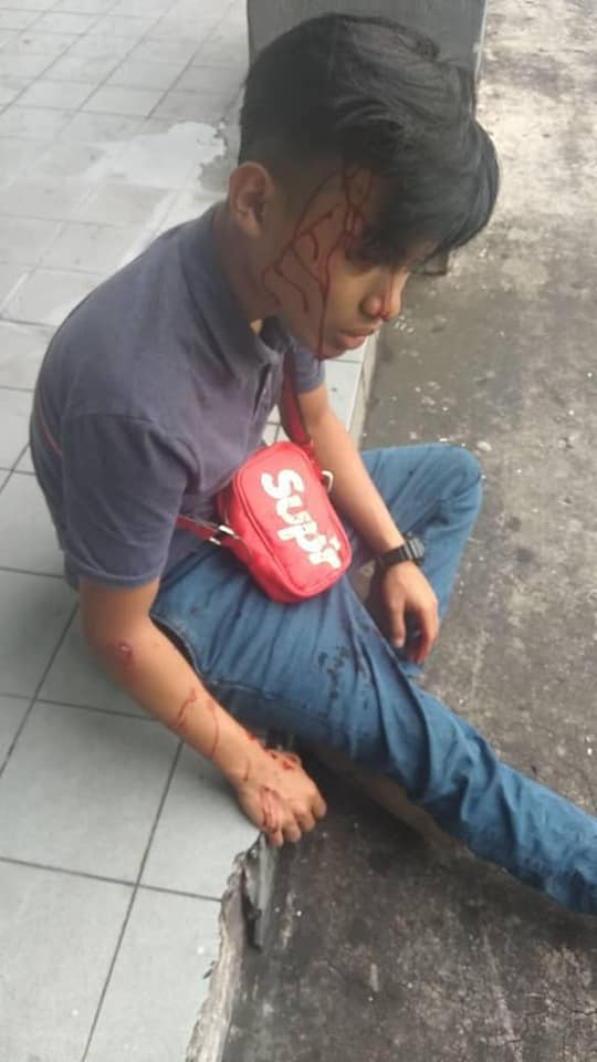 Boy's Head Left Bloodied After Being Struck By Bicycle Part Thrown From Flat - WORLD OF BUZZ 7