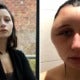 Girl'S Head And Tongue Swell Severely Due To Near-Fatal Allergic Reaction To Hair Dye - World Of Buzz 3