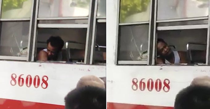 Man Hangs His Arm Outside Window While Sleeping, Gets Hit By Another Bus And Loses It - World Of Buzz