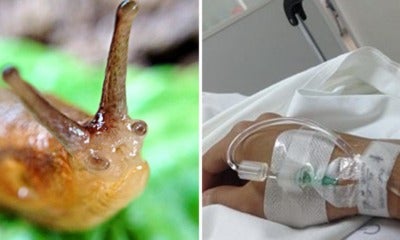 Teenager Dared By Friends To Eat Slug, Falls Into Coma &Amp; Dies 8 Years Later - World Of Buzz 2