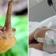 Teenager Dared By Friends To Eat Slug, Falls Into Coma &Amp; Dies 8 Years Later - World Of Buzz 2