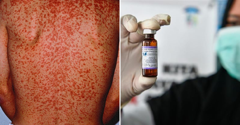 Travellers Advised To Get Vaccinated Before Going To Thailand Due To Measles Outbreak - World Of Buzz 4