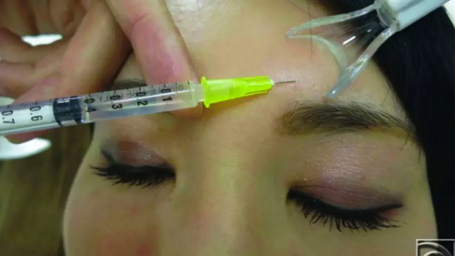 Woman Faints and Dies After Getting 16 Botox Injections At Beauty Clinic - WORLD OF BUZZ 2