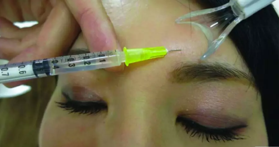 Woman Faints and Dies After Getting 16 Botox Injections At Beauty Clinic - WORLD OF BUZZ 3