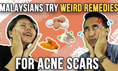 Malaysians Try Weird Remedies For Acne Scars - World Of Buzz 1