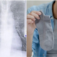Man'S Weird Habit Of Sniffing His Smelly Socks Caused Him To Develop Severe Fungal Infection In His Lungs - World Of Buzz
