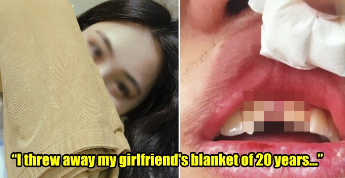 BF Throws Away GF's 'Bantal Busuk' Of 20 Years, Gets Punched In The Face With Tooth Broken - WORLD OF BUZZ