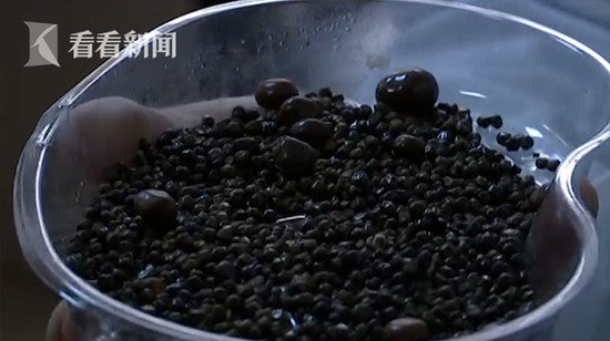 Doctors Remove Over 2,000 Gallstones From Woman Who Doesn't Eat Breakfast &Amp; Drinks Less Water - World Of Buzz 2