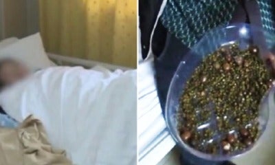 Doctors Remove Over 2,000 Gallstones From Woman Who Doesn'T Eat Breakfast &Amp; Drinks Less Water - World Of Buzz 3