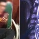 Man Always Lies On Sofa To Play Phone, Damages Spinal Cord And Almost Paralysed - World Of Buzz 3