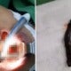 Surgeons Removing Woman'S Throat Tumor Discover It'S Actually Huge 2-Inch Leech. - World Of Buzz 1