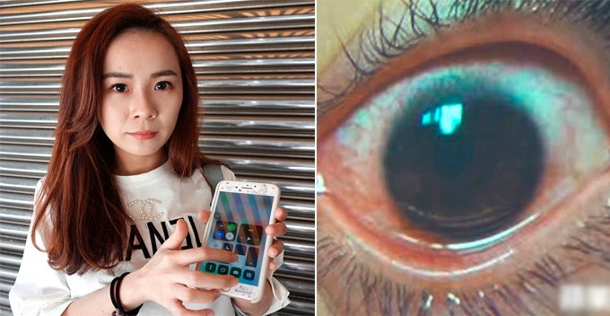 25Yo Lady Uses Phone With Maximum Screen Brightness, Cornea Gets Damaged With 500 'Holes' - World Of Buzz