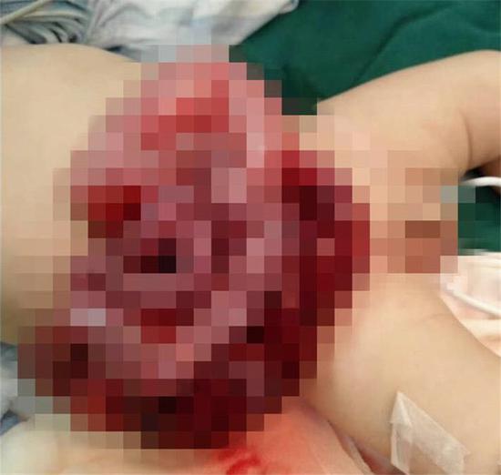 Baby's Intestines Spilled Out Of His Stomach After Father Made A Small Cut To Let Out Gas - WORLD OF BUZZ 3