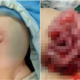 Baby'S Intestines Spilled Out Of His Stomach After Father Made A Small Cut To Let Out Gas - World Of Buzz 4