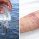 Expert Warns That Increased Amount Of Deadly Box Jellyfish Expected To Invade Sabah From March Until June - World Of Buzz 2
